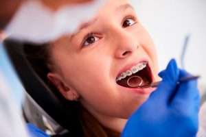 Исправление прикуса в стоматологии MDent